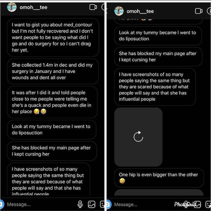 Botched Plastic Surgery- Nigerian Lady Calls Out Her Doctor