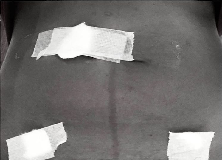 Actress Zainab Balogun Opens Up On Her Struggle With Stage 4 Endometriosis